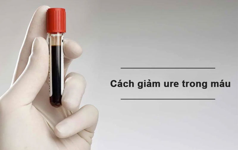 Hướng Dẫn Cách Giảm Urê Trong Máu An Toàn, Hiệu Quả