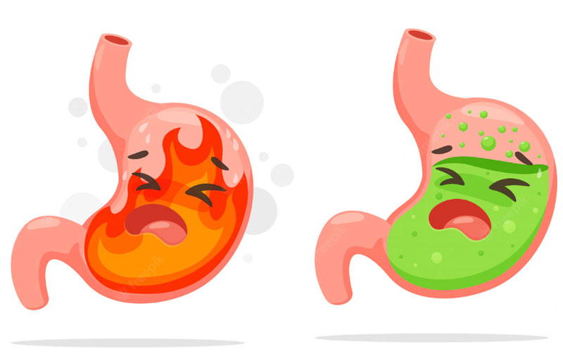 Triệu Chứng Điển Hình Và Cách Điều Trị Dứt Điểm Bệnh Đau Dạ Dày