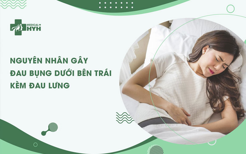 đau bụng dưới bên trái kèm đau lưng